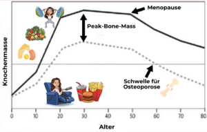 Über sechs Millionen Deutsche leiden unter Osteoporose (Knochenschwund) - davon zu 80 % Frauen. Da die Erkrankung oft erst entdeckt wird, wenn es schon zu spät ist, erklären wir Dir hier in diesem Artikel, wie Du Osteoporose vorbeugen kannst. www.mybodyartist.de